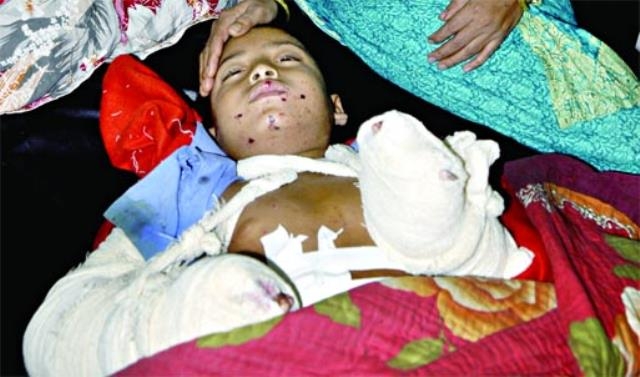 Wrists of a minor boy was blown away from explosion of an abandoned bomb in city's Badda area on Monday morning.