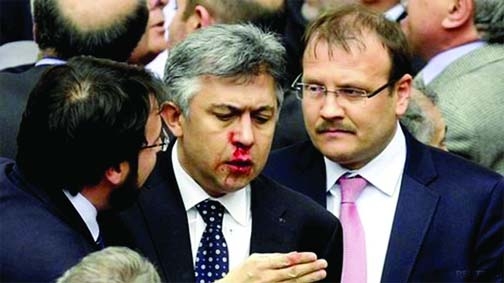 Opposition MP Ali Ihsan Kokturk pictured after his nose was broken in the brawl.