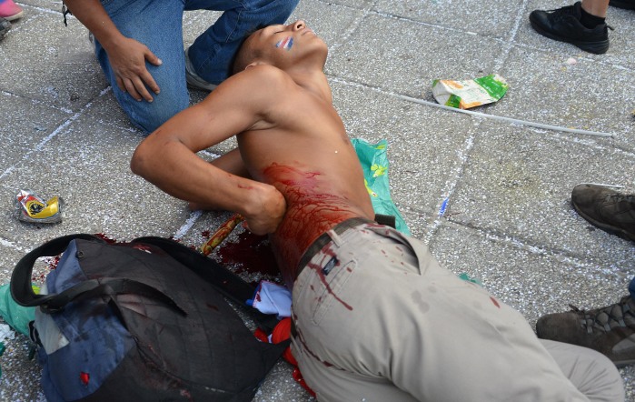 A Costa Rican fan lies on the street after being stabbed in his back in the Parque de la Democracia in downtown San JosÃ©, while watching Costa Rica play the Netherlands in the World Cup quarterfinal on Saturday.