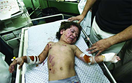 Mohammed Al Awaj, 4, cries while doctors treat him for his injuries following an Israeli airstrike on a vehicle, as he lies on the bed at Nasser hospital in Khan Younis, southern Gaza Strip on Thursday. Photo: Agency