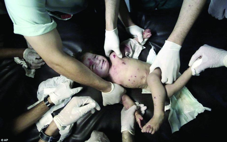 This child was one of many Palestinians injured on Thursday night as Israeli bombs rained down on Gaza, destroying homes and other targets. Internet photo