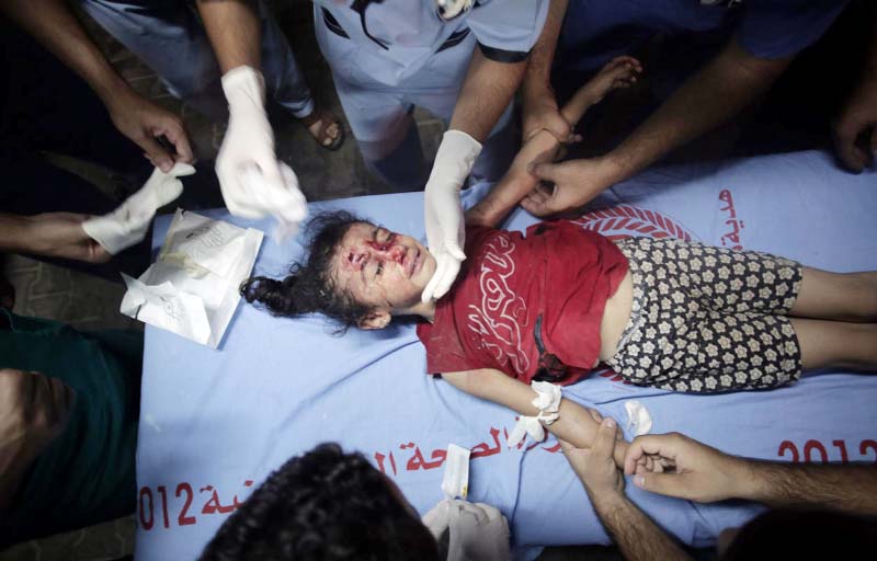 Palestinian medics treat a wounded girl, at the Kuwaiti hospital at Rafah refugee camp, in southern Gaza Strip on Monday.