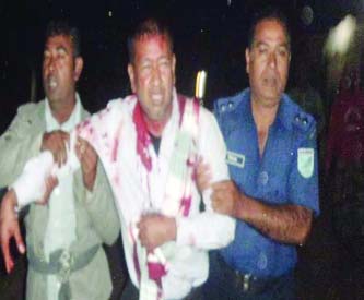 Seriously injured Jhinaigati Upazila Awami League Convener Warez Nayeem.