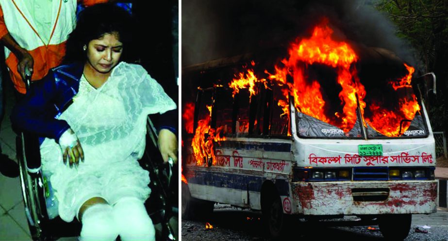 One of the two Eden College girls who received burn injuries following petrol bomb attack on their bus by miscreants, being given treatment at the Burn Unit of DMCH. The ill-fated bus (right) is seen burning after the attack.