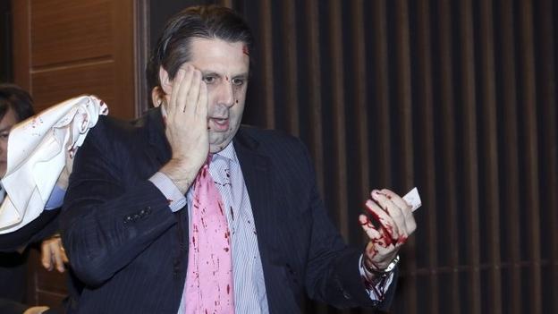 Mark Lippert was filmed moments after the attack asking to be taken to hospital