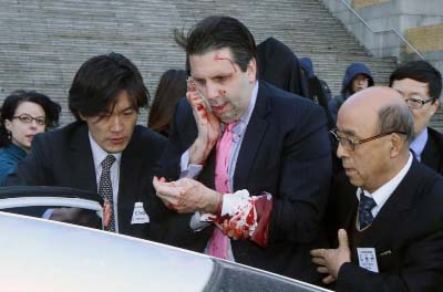 Injured U.S. Ambassador to South Korea Mark Lippert, centre, gets into a car to leave for a hospital in Seoul, South Korea on Thursday.