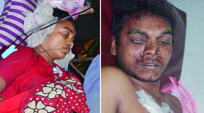 RAJSHAHI: Four members of a family who were injured in clash over land dispute are now under going treatment at local hospital.