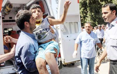 A wounded child is brought to the hospital in Suruc in Turkey's Sanliurfa after a deadly bombing in Kobane, across the border in Syria.
