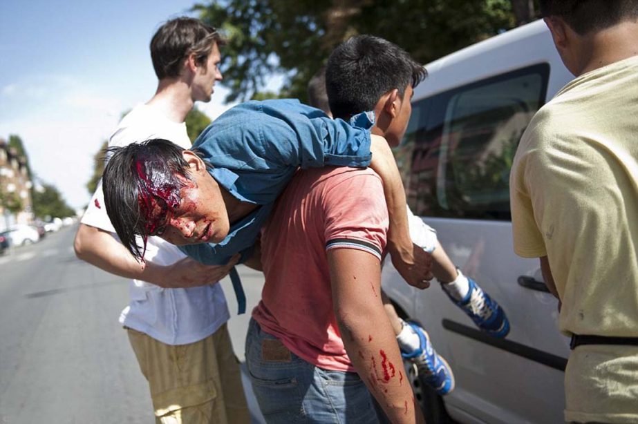 A man with a head injury is carried by another migrant after violence has broken out between Syrians and Afghans this afternoon.