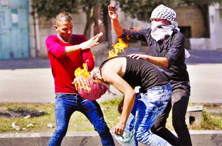 Palestinian protesters put out a fire burning on a compatriot, caused by a molotov cocktail which he was trying to hurl at Israeli troops during clashes in the West Bank city of Hebron on Tuesday. Internet photo