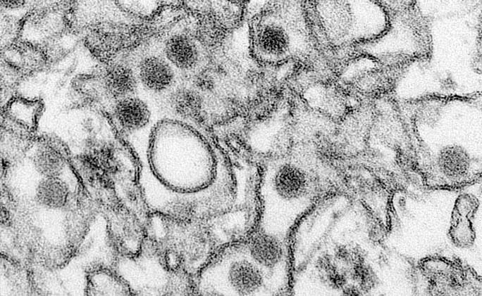 A transmission electron micrograph (TEM) shows the Zika virus.