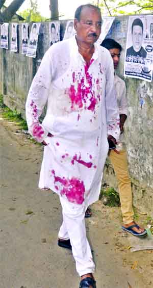 Miscreants beat and injured BNP nominated chairman candidate Abdul Khaleque Sikdar when he tried to resist stuffing ballots at a polling centre of Rasunia Union in Munshiganj district on Tuesday.