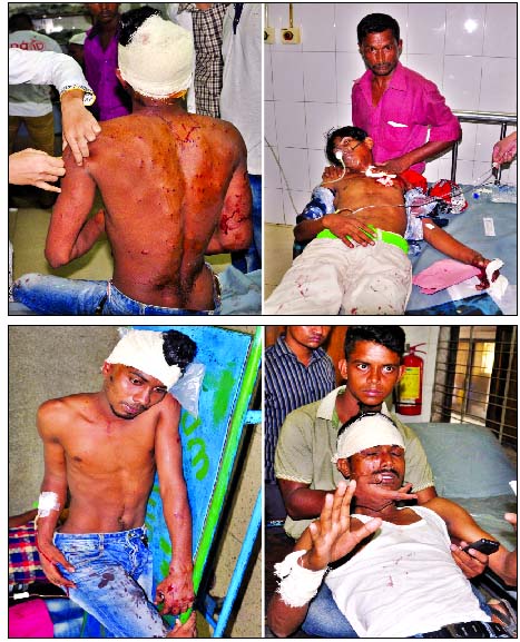 Four injured people, who suffered bullet injuries in a clash between rival groups of Awami League in city's Mirpur area being hospitalised on Sunday.