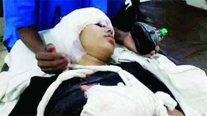 Unconscious Khadiza Akhter now fighting for life at city's Square Hospital.