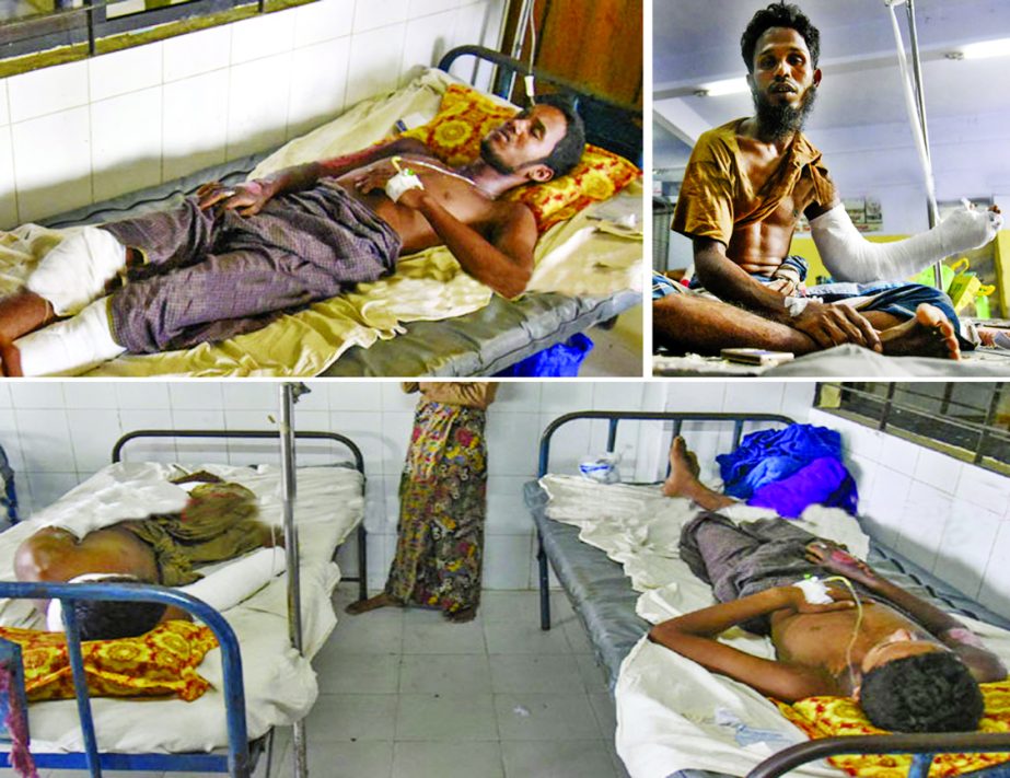 Some of Rohingyas, who sustained bullet wounds by Myanmar security forces, were admitted to Chittagong Medical College Hospital on Monday.