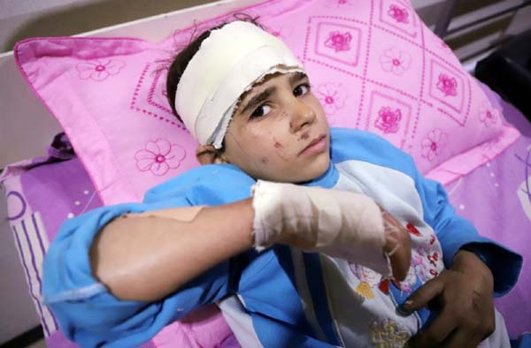 Seven-year-old Manar was injured in an air strike on her home in Eastern Ghouta that killed several members of her family