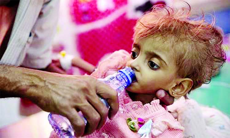 A father gives water to his malnourished daughter at a feeding center in a hospital in Hodeida.