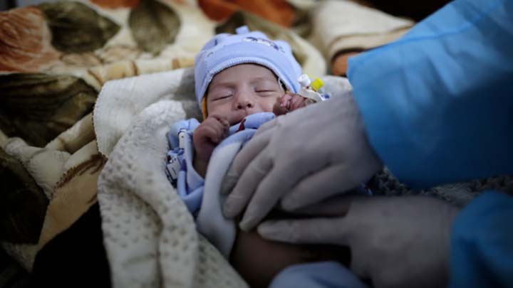 A doctor checks two-month-old Mujahed Ali, suffering from a cholera infection, at Al-Sabeen hospital, in Sanaa, Yemen.