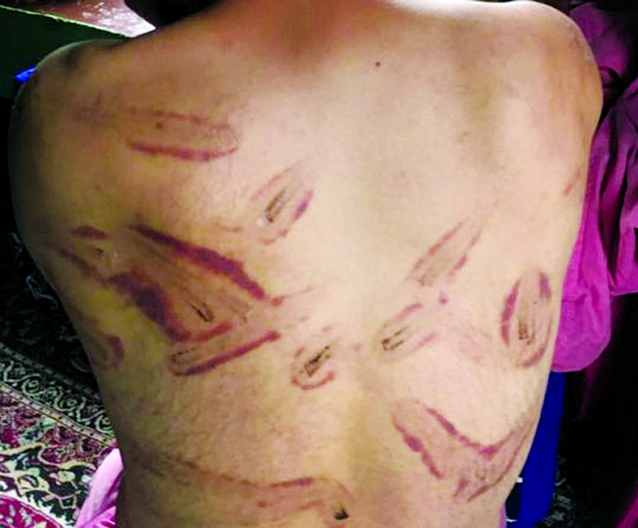 People in occupied Kashmir have accused Indian security forces of carrying out beatings and torture. Photo courtesy BBC