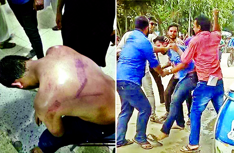 At least 9 JCD activists were injured in attack by BCL men on the DU campus on Monday.