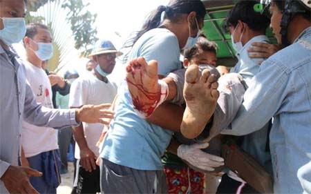 A wounded protester is carried amid protests against the military coup in Dawei, Myanmar on Sunday.