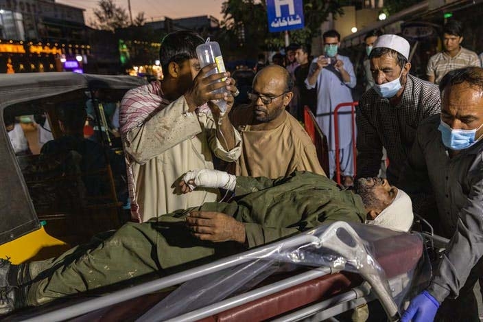 A person wounded in a bomb blast outside the Kabul airport in Afghanistan on Thursday, Aug. 26, 2021, arrives at a hospital in Kabul.