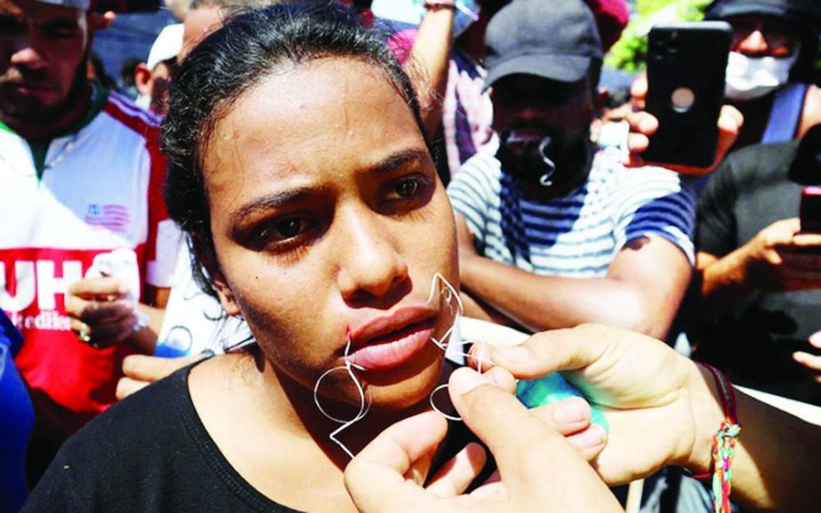 A migrant begins a hunger strike with her mouth sewed shut during a protest to demand free transit through the country outside the office of the National Migration Institute (INM) in Tapachula, Mexico on Tuesday. Agency photo