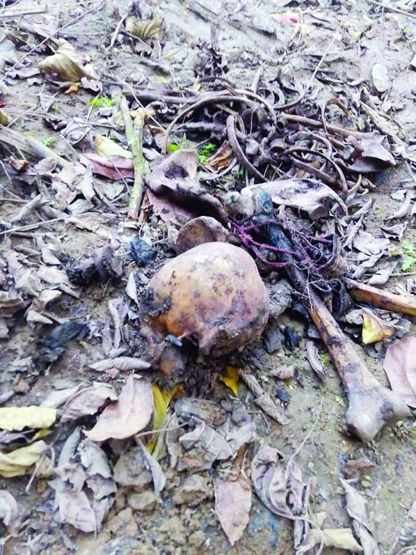 GAZIPUR: Human skeletons recover from an abandoned pond at Bagherbazar in Gazipur Sadar Upazila on Friday.