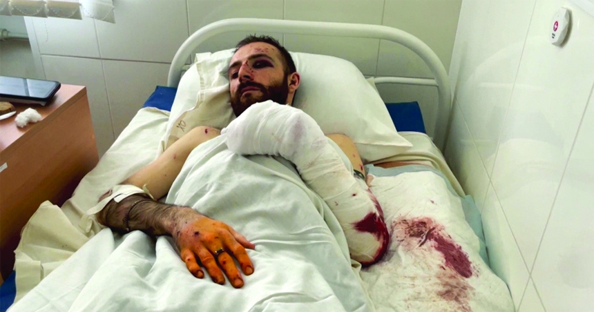 A wounded patient takes treatment at a hospital in Kyiv, Ukraine on Thursday.