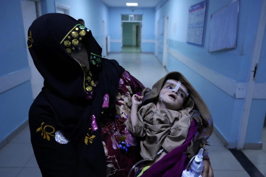 woman holds her malnourished baby at the Ataturk Children's Hospital in Kabul, Afghanistan, Wednesday, May 18, 2022.